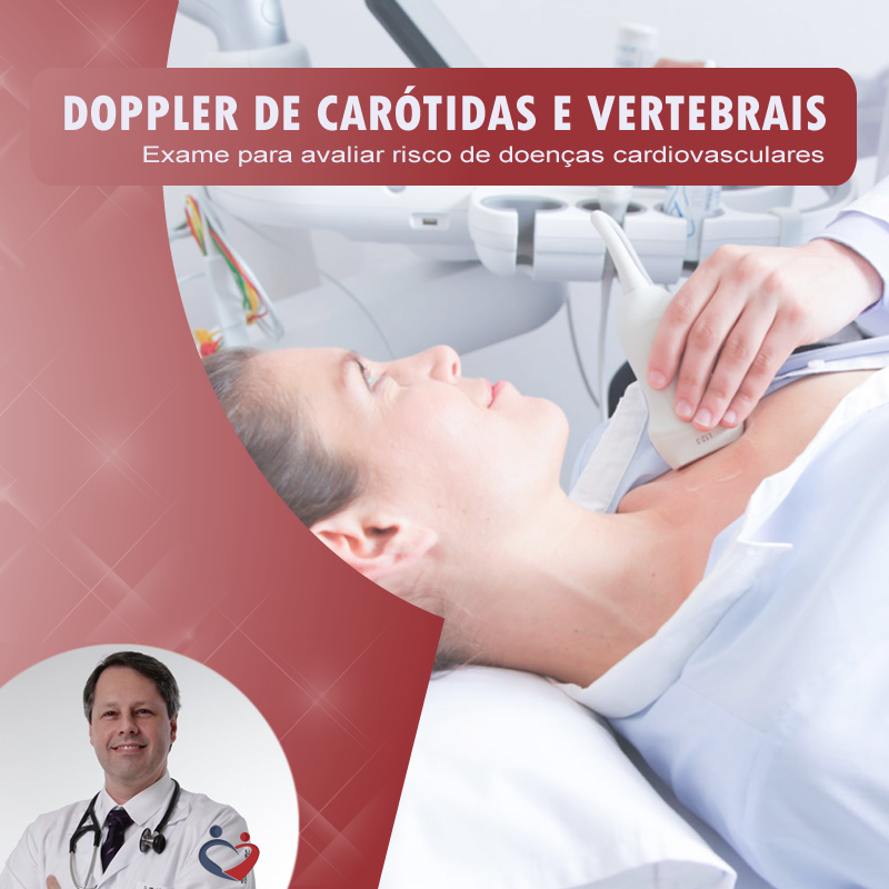 Doppler de Carótidas e Vertebrais