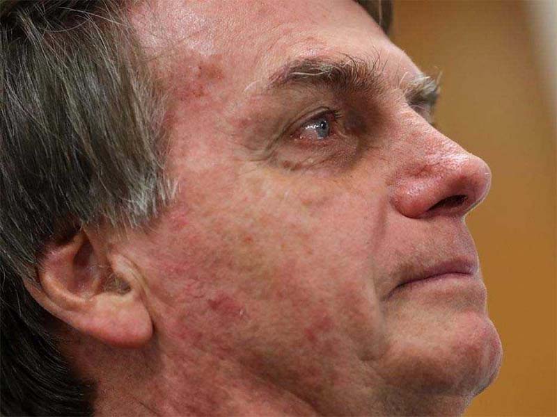 Presidente Jair Bolsonaro tem alta na manhã deste domingo (18)