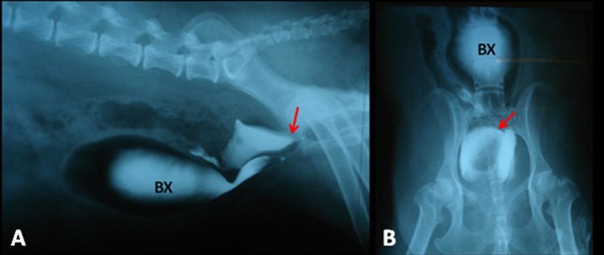 Uretrocistoscopia